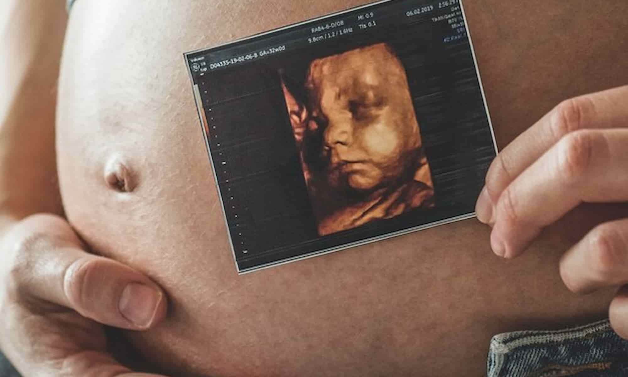 Mulher gravida segurando foto de ultrassom de bebe